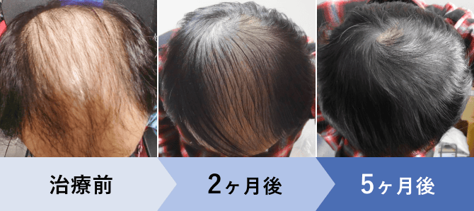 30代男性の治療例