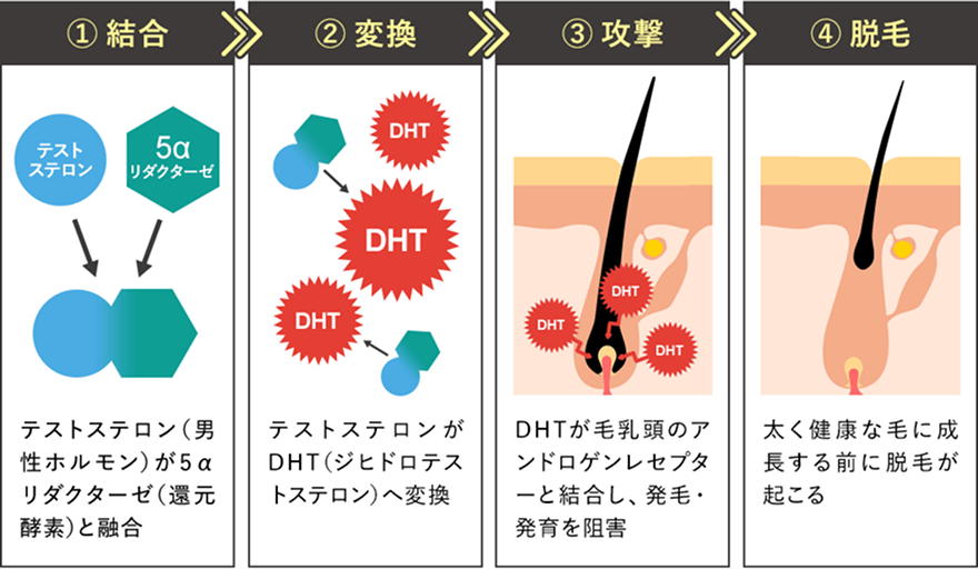 AGAのメカニズム図解