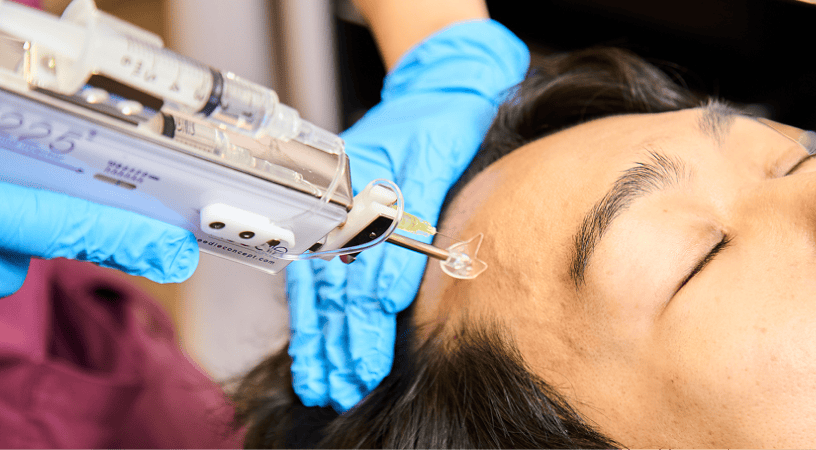 メソセラピー画像