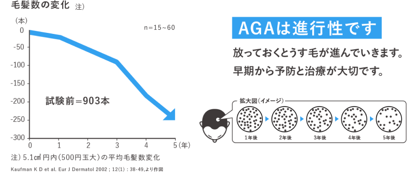 毛髪数の変化