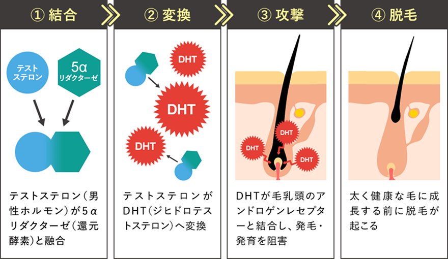 AGAのメカニズム図解