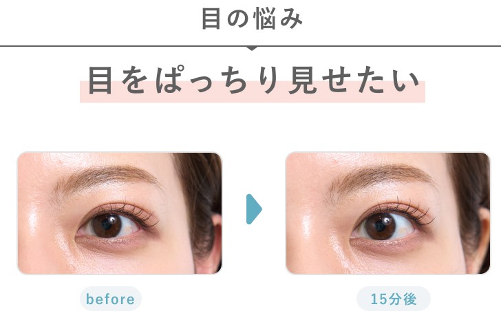 目の悩み 目をぱっちり見せたい