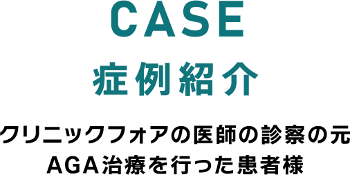 症例紹介 クリニックフォアの医師の診察の元、AGA治療を行った患者様