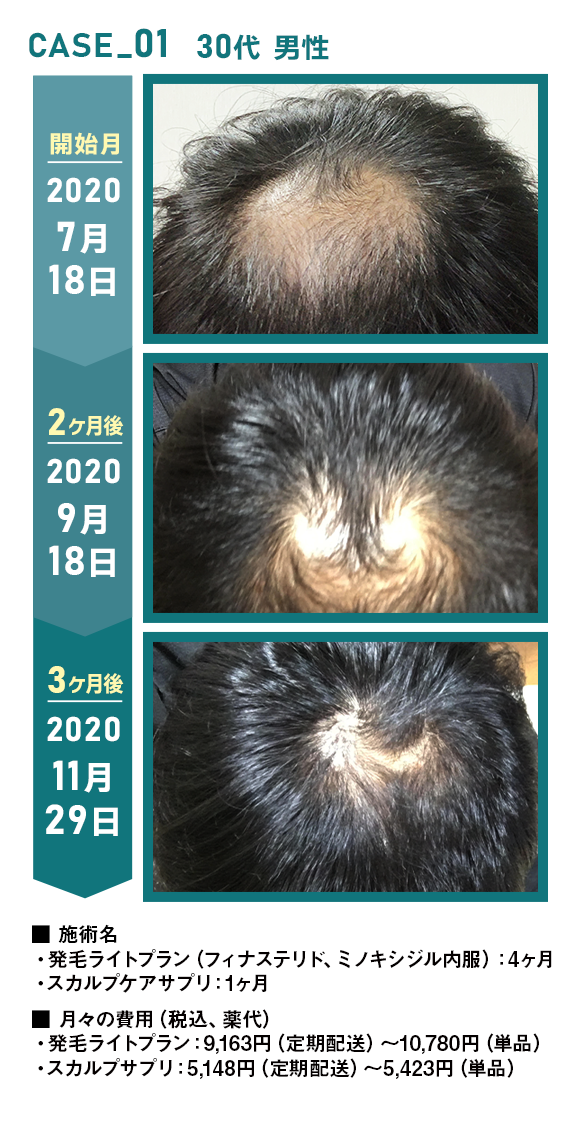 CASE_01 30代 男性