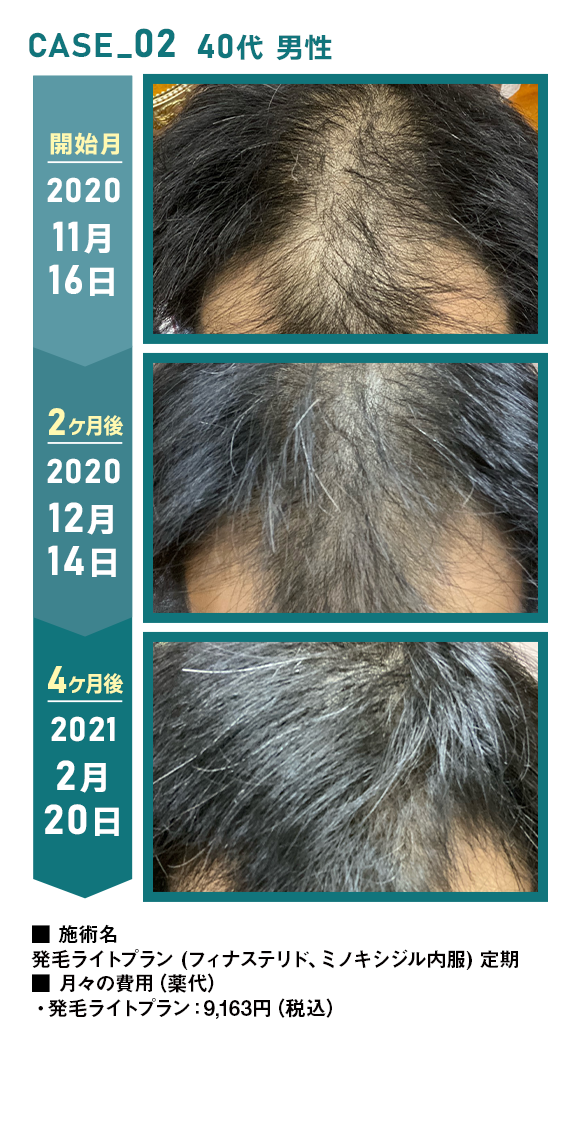 CASE_02 40代 男性