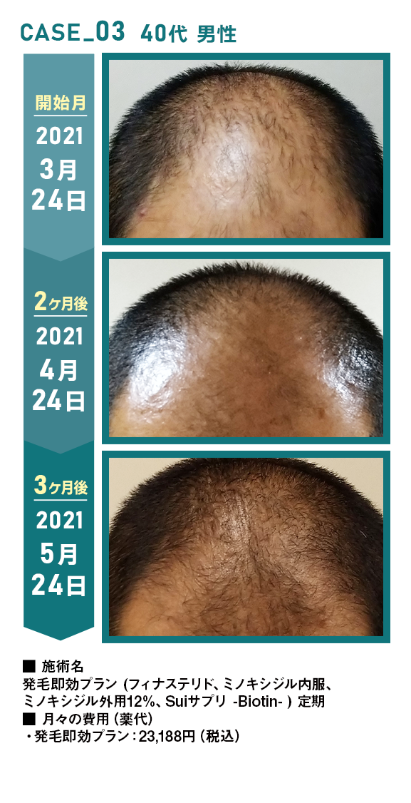 CASE_03 40代 男性