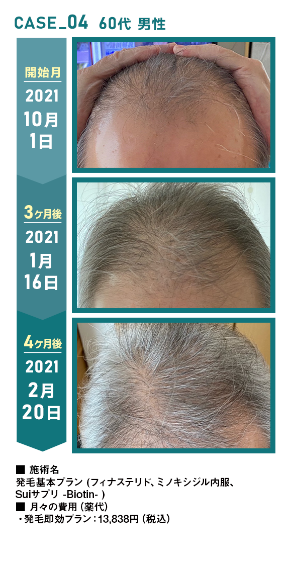 CASE_04 60代 男性