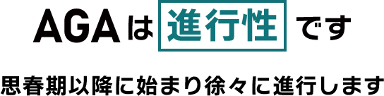 AGAは進行性です 思春期以降に始まり徐々に進行します
