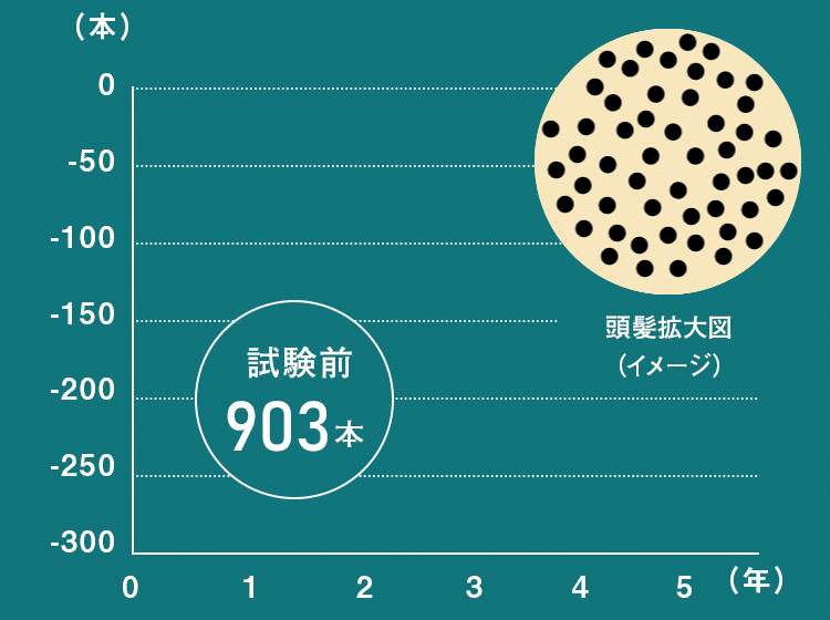 毛髪量の変化