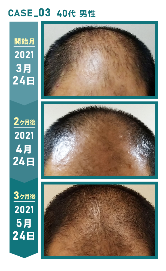 CASE_03 40代 男性