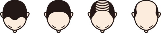 前頭部
