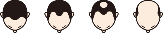 生え際