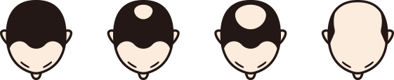 頭頂部