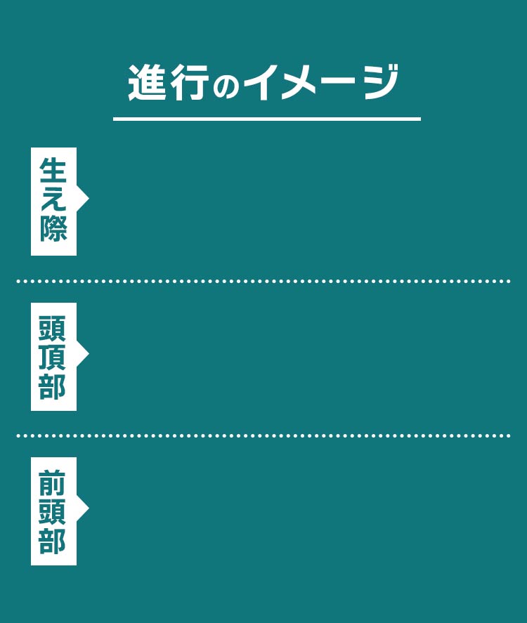 毛髪数の変化 進行のイメージ