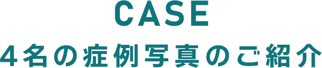 症例紹介 クリニックフォアの医師の診察の元、AGA治療を行った患者様