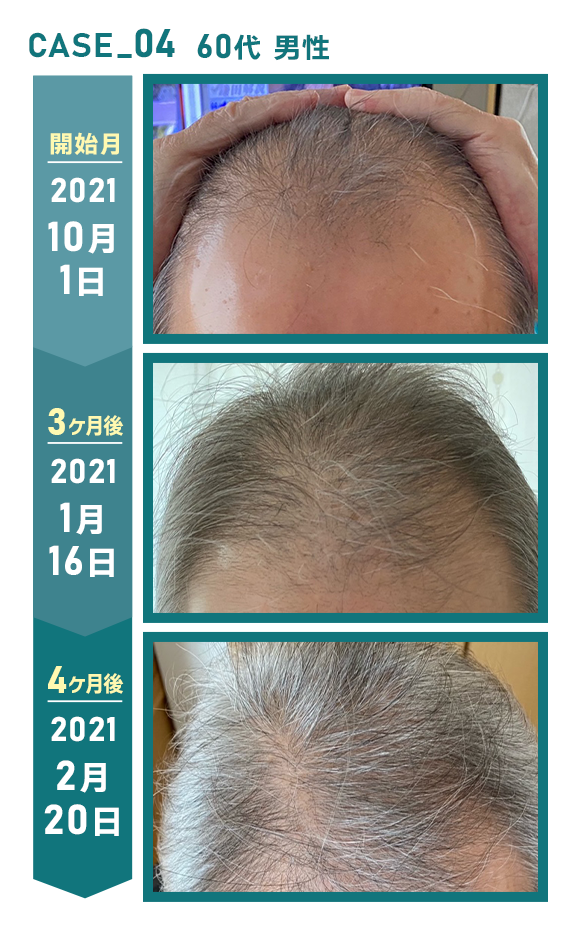 CASE_04 60代 男性