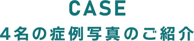 症例紹介 クリニックフォアの医師の診察の元、AGA治療を行った患者様