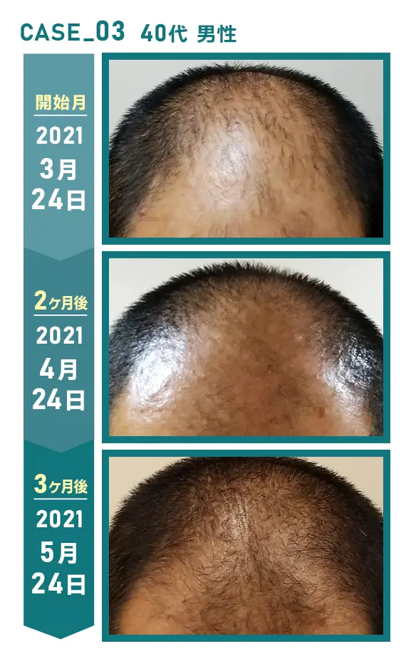 CASE_03 40代 男性