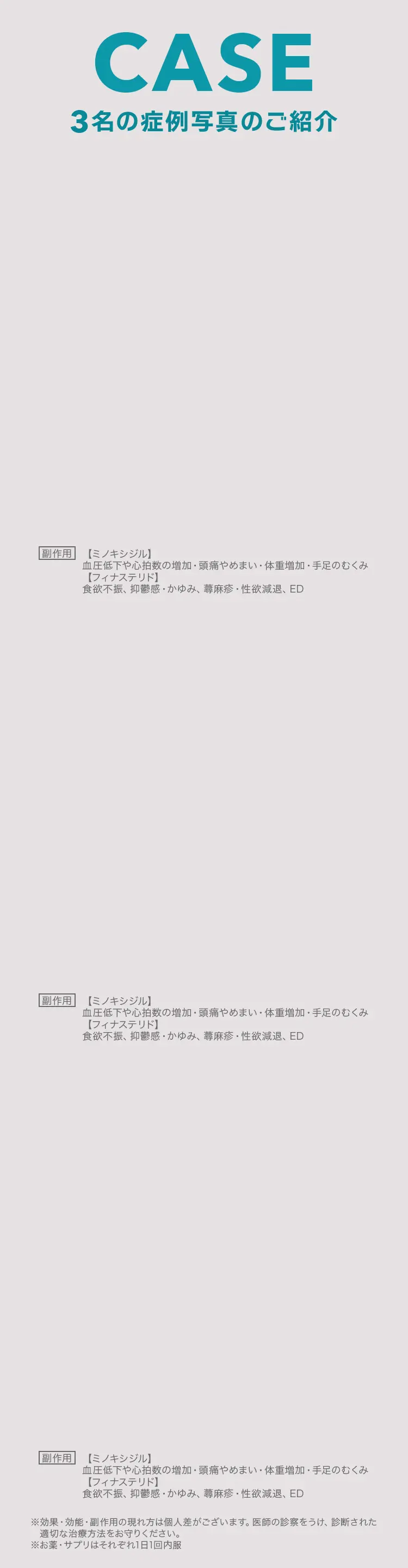 薬による副作用(リスク)
