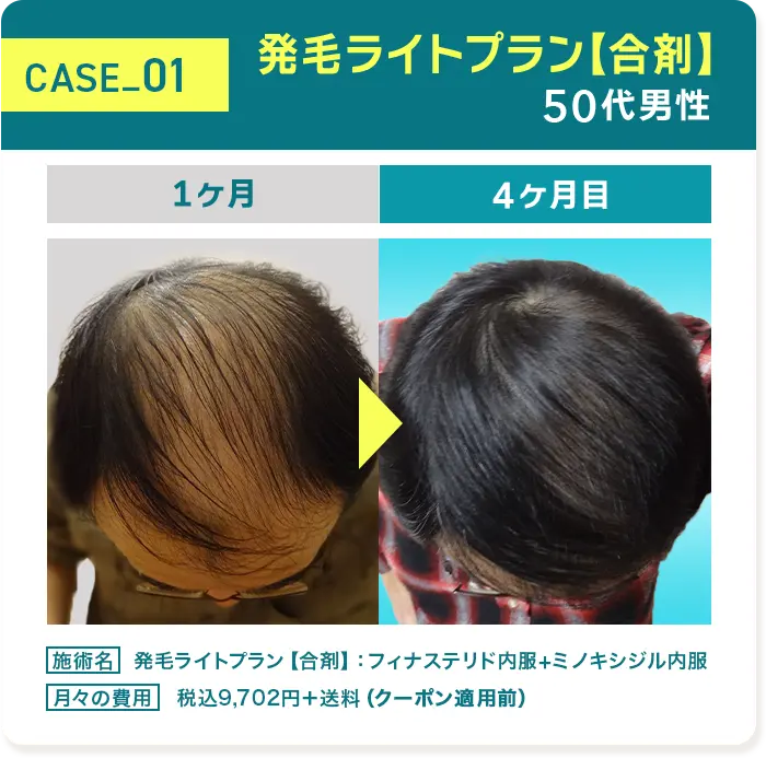 CASE01