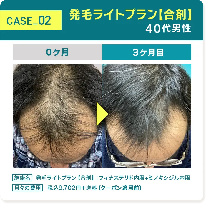 CASE02