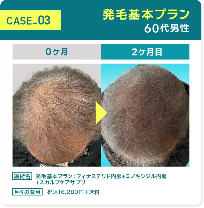 CASE03