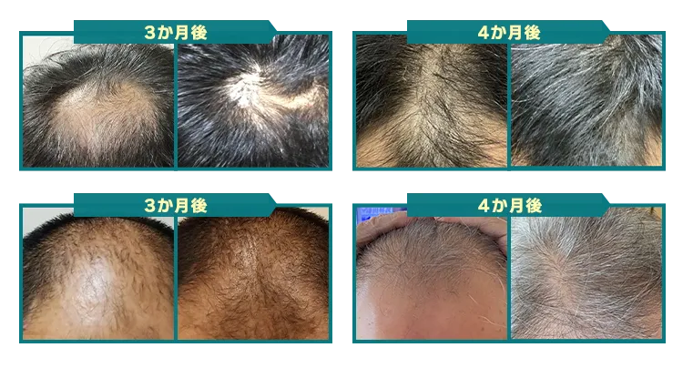 3ヶ月後〜4ヶ月後