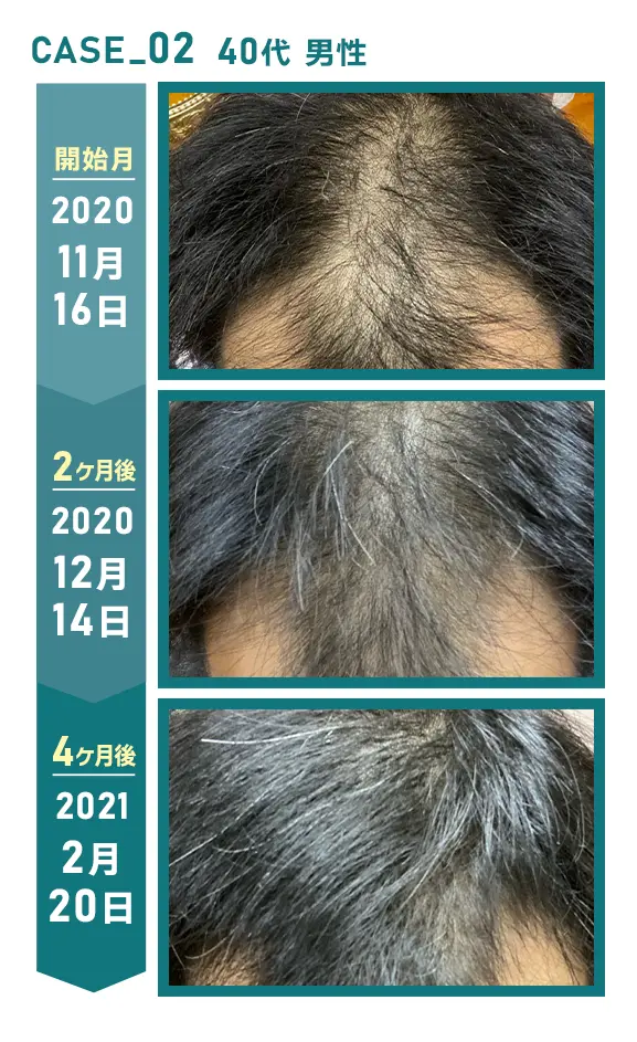 CASE_02 40代 男性