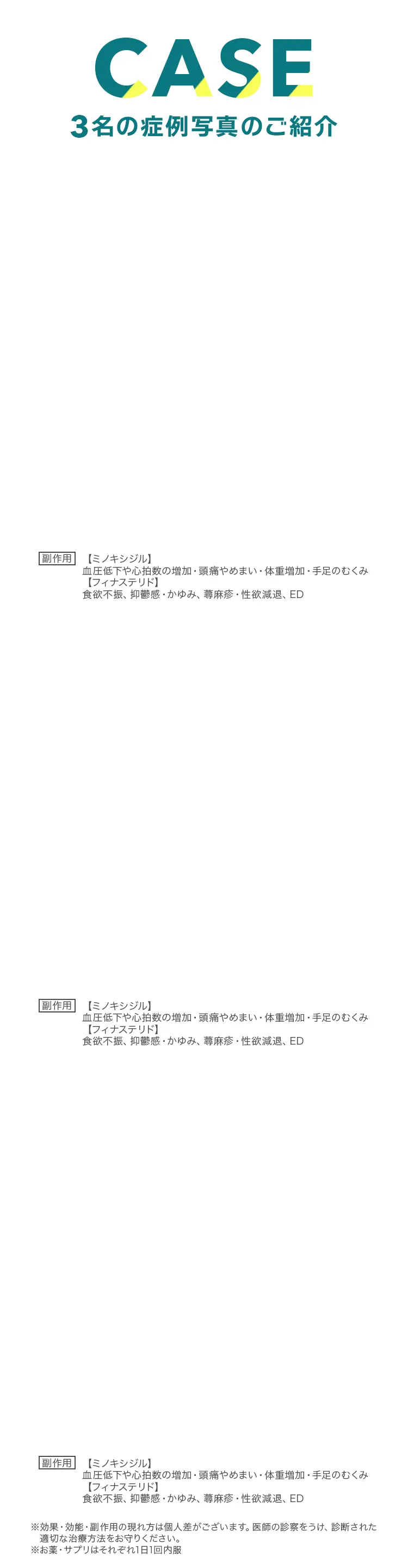 薬による副作用(リスク)