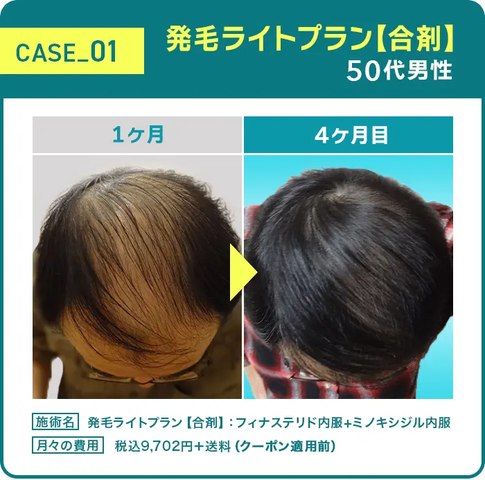 CASE01