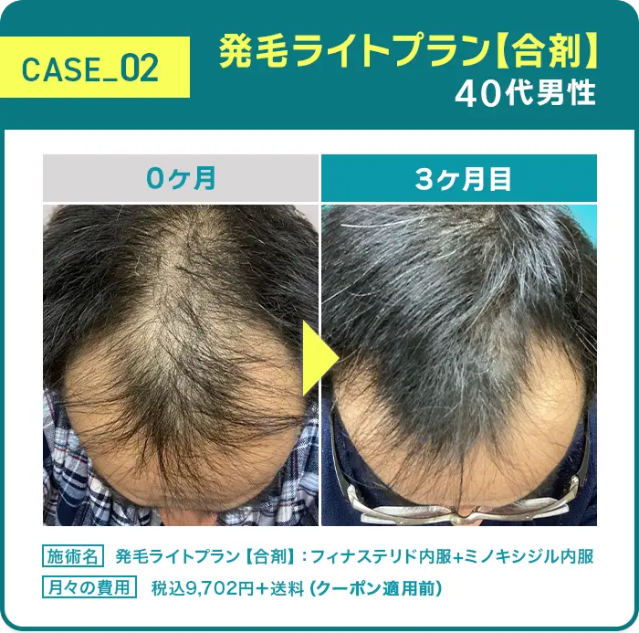 CASE02