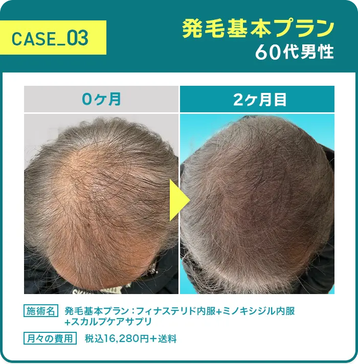 CASE03