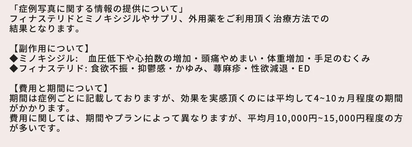 【症例写真に関する情報の提供について】フィナステリドとミノキシジルやサプリ、外用薬をご利用頂く治療方法での結果となります