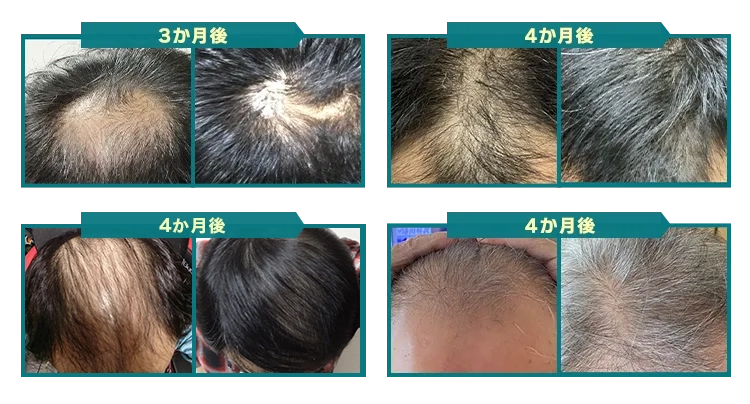 3ヶ月後〜4ヶ月後