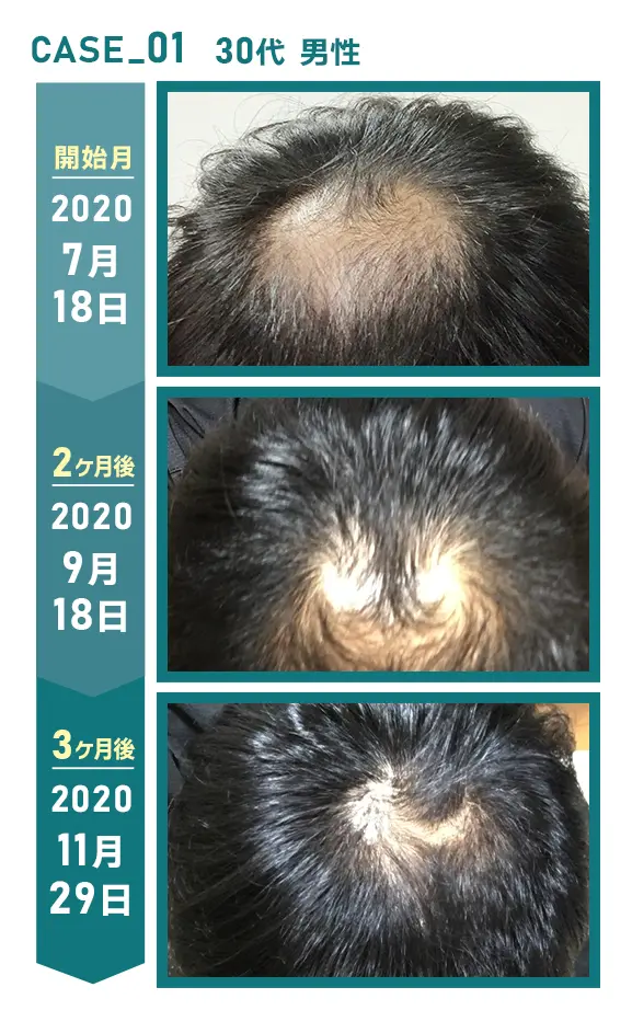 CASE_01 30代 男性