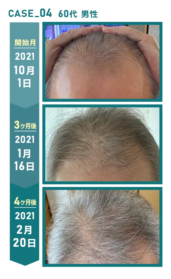 CASE_04 60代 男性