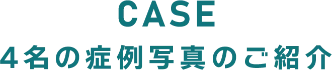 症例紹介 クリニックフォアの医師の診察の元、AGA治療を行った患者様