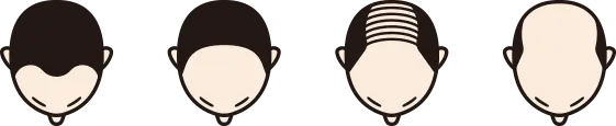 前頭部
