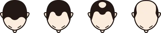 生え際