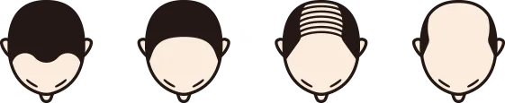 前頭部