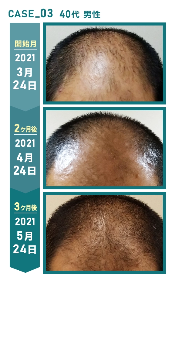 CASE_03 40代 男性
