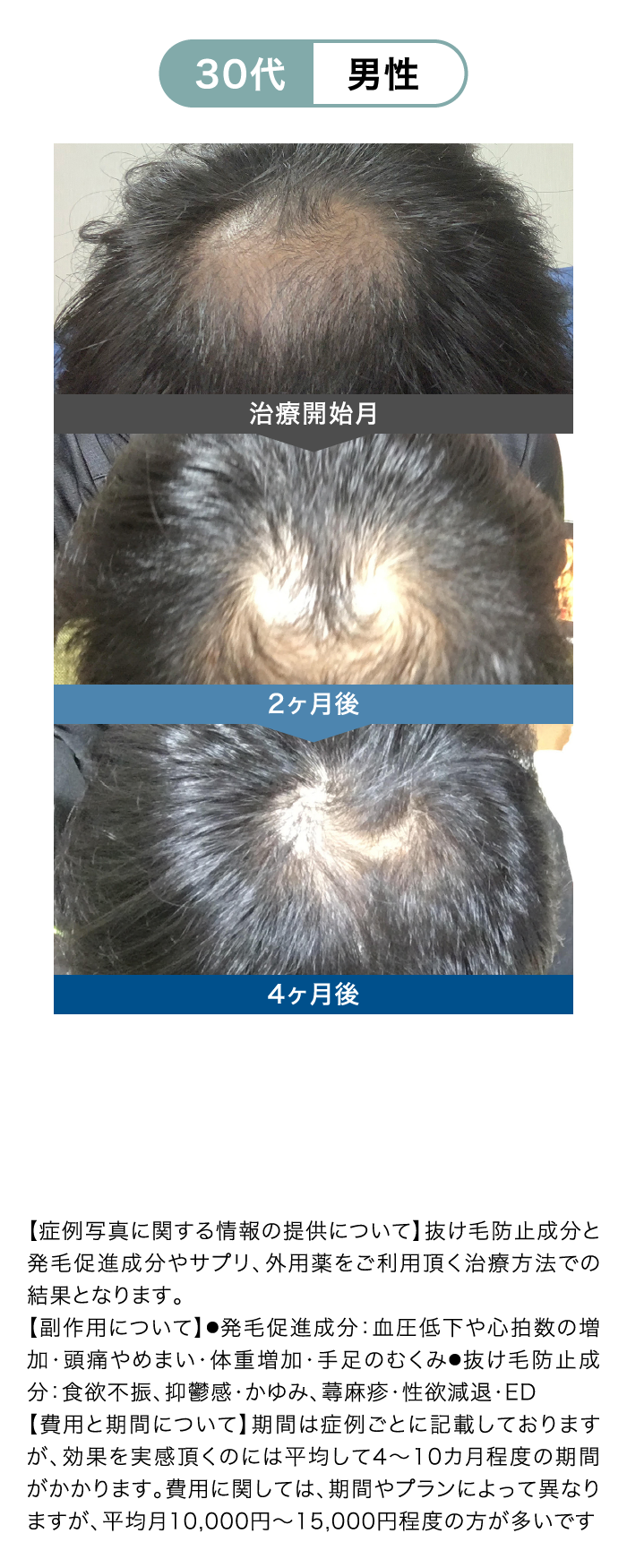 CASE1