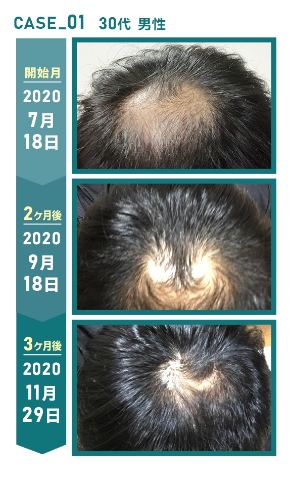30代男性