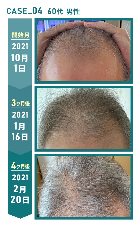 60代男性