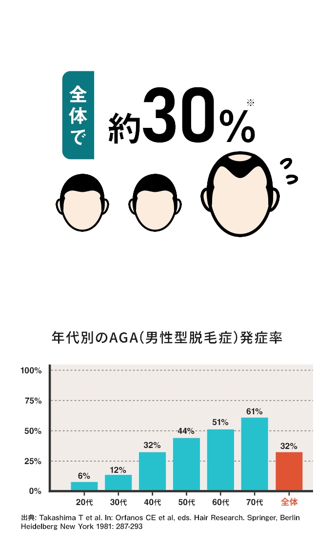 日本人男性のAGA発症率は約30％！