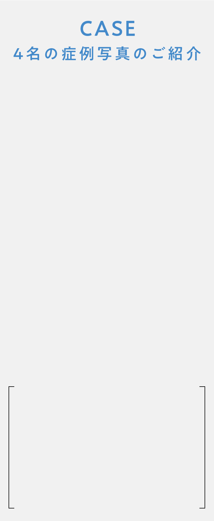 CASE 4名の症例写真のご紹介