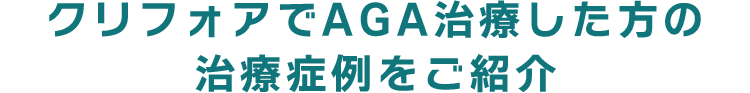 クリフォアでAGA治療した方の治療症例をご紹介