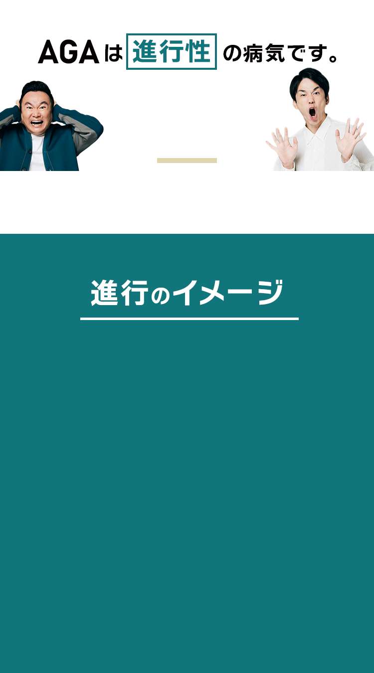AGAは進行性の病気です。
