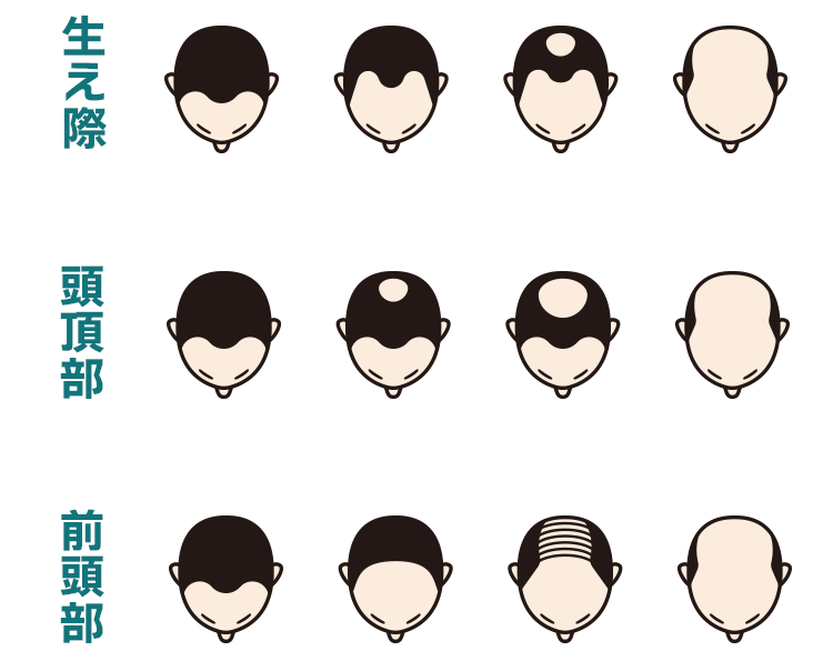 進行のイメージ