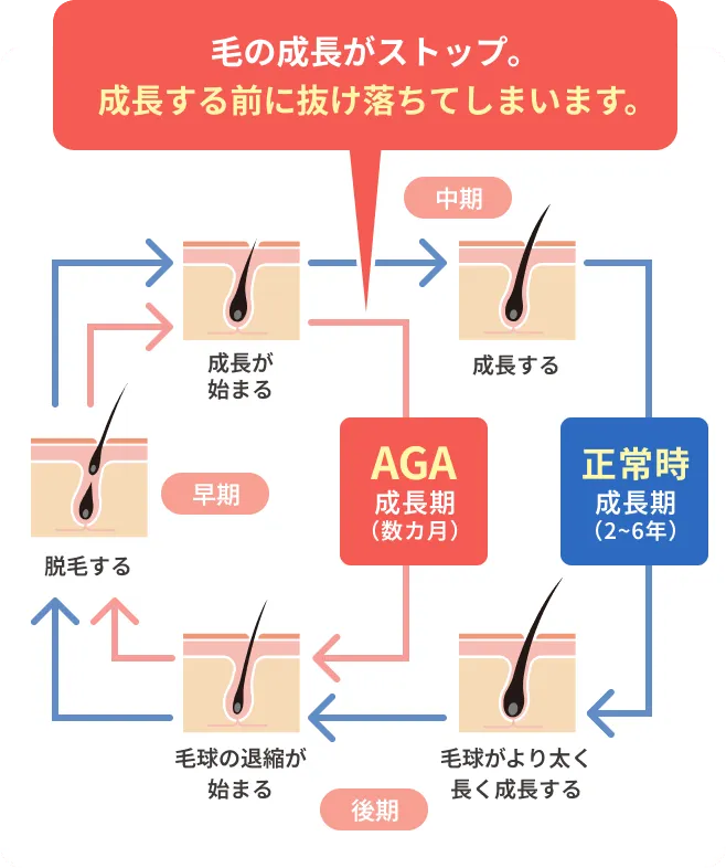 毛の成長がストップ。成長する前に抜け落ちてしまいます。